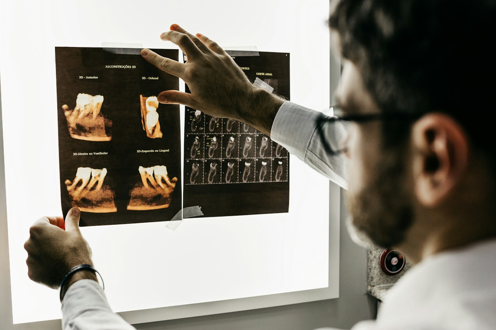 Dentist reviewing dental x-ray scans on a light box.