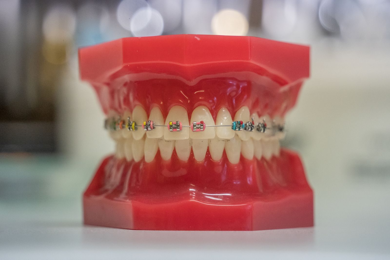 Orthodontic teeth model with braces.
